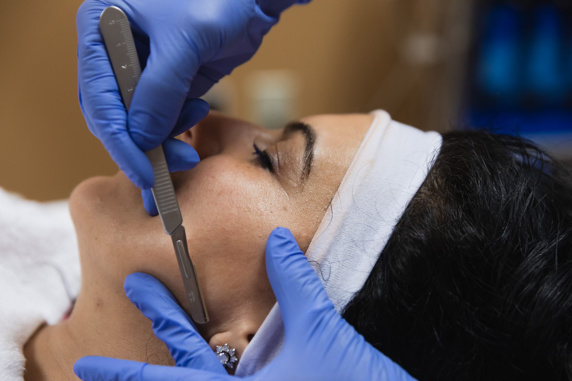 Woman with long hair getting dermablading in Wayzata
