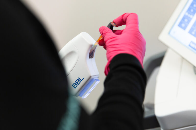 A professional wearing pink gloves prepares a device for laser hair removal near Minnetonka, MN