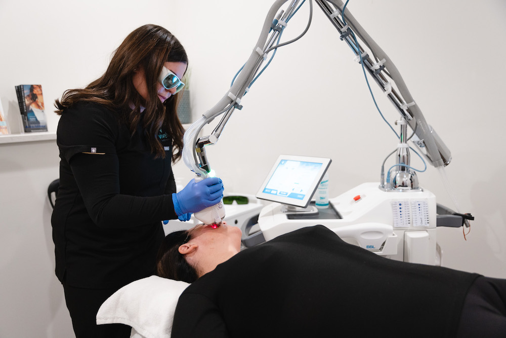 Patient receiving laser skin resurfacing in Minneapolis